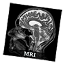 mri