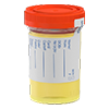 urine